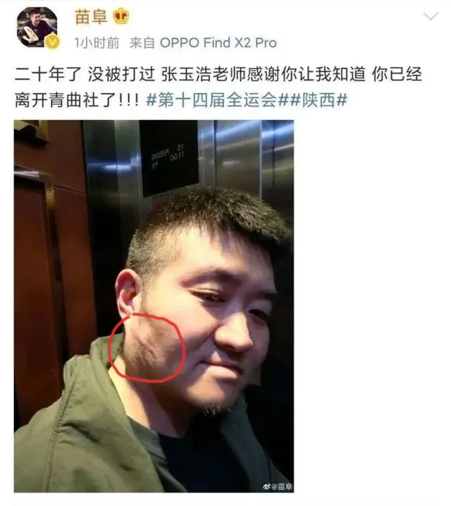 苗阜發微自爆被打后秒刪,打人者張玉浩發微“因果有循環” 相聲新勢力 青曲社 相聲 張玉浩 苗阜 3030說 第1張 苗阜發微自爆被打后秒刪,打人者張玉浩發微“因果有循環” 相聲新勢力 青曲社 相聲 張玉浩 苗阜 3030說 第1張